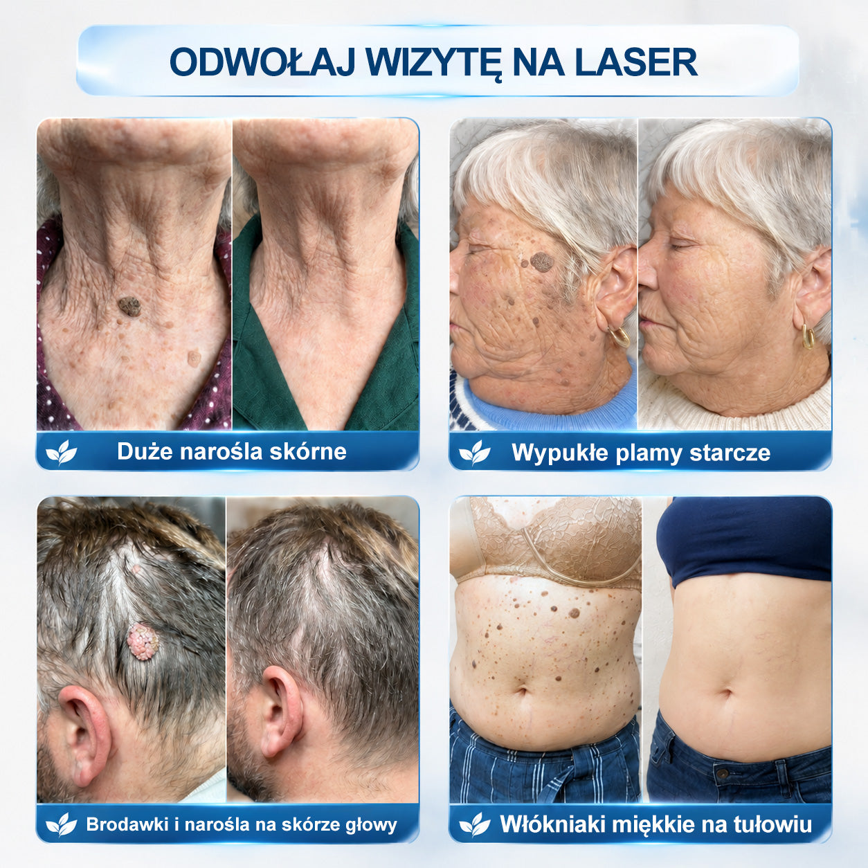 𝐏i𝐜𝐝o® 🌱7 𝑫𝒏𝒊 𝑷𝒓𝒆𝒑𝒂𝒓𝒂𝒕 𝑫𝒐 𝑼𝒔𝒖𝒘𝒂𝒏𝒊𝒂 𝑾łó𝒌𝒏𝒊𝒂𝒌ó𝒘 𝑴𝒊ę𝒌𝒌𝒊𝒄𝒉 𝑰 𝑷𝒓𝒛𝒆𝒃𝒂𝒓𝒘𝒊𝒆ń(𝐁𝐞𝐳 𝐁ó𝐥𝐮, 𝐁𝐞𝐳 𝐁𝐥𝐢𝐳𝐧 – 𝐑𝐨𝐥𝐥-𝐨𝐧)💪