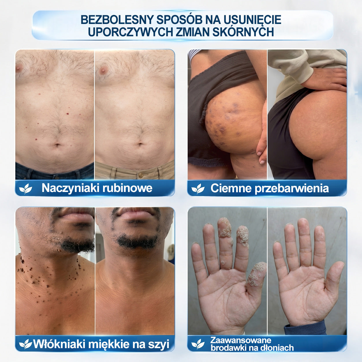 𝐏i𝐜𝐝o® 🌱7 𝑫𝒏𝒊 𝑷𝒓𝒆𝒑𝒂𝒓𝒂𝒕 𝑫𝒐 𝑼𝒔𝒖𝒘𝒂𝒏𝒊𝒂 𝑾łó𝒌𝒏𝒊𝒂𝒌ó𝒘 𝑴𝒊ę𝒌𝒌𝒊𝒄𝒉 𝑰 𝑷𝒓𝒛𝒆𝒃𝒂𝒓𝒘𝒊𝒆ń(𝐁𝐞𝐳 𝐁ó𝐥𝐮, 𝐁𝐞𝐳 𝐁𝐥𝐢𝐳𝐧 – 𝐑𝐨𝐥𝐥-𝐨𝐧)💪