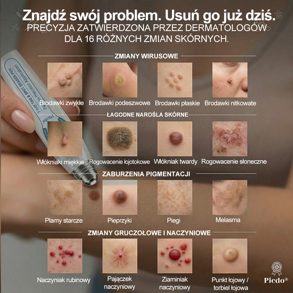 𝐏i𝐜𝐝o® 🌱7 𝑫𝒏𝒊 𝑷𝒓𝒆𝒑𝒂𝒓𝒂𝒕 𝑫𝒐 𝑼𝒔𝒖𝒘𝒂𝒏𝒊𝒂 𝑾łó𝒌𝒏𝒊𝒂𝒌ó𝒘 𝑴𝒊ę𝒌𝒌𝒊𝒄𝒉 𝑰 𝑷𝒓𝒛𝒆𝒃𝒂𝒓𝒘𝒊𝒆ń(𝐁𝐞𝐳 𝐁ó𝐥𝐮, 𝐁𝐞𝐳 𝐁𝐥𝐢𝐳𝐧 – 𝐑𝐨𝐥𝐥-𝐨𝐧)💪