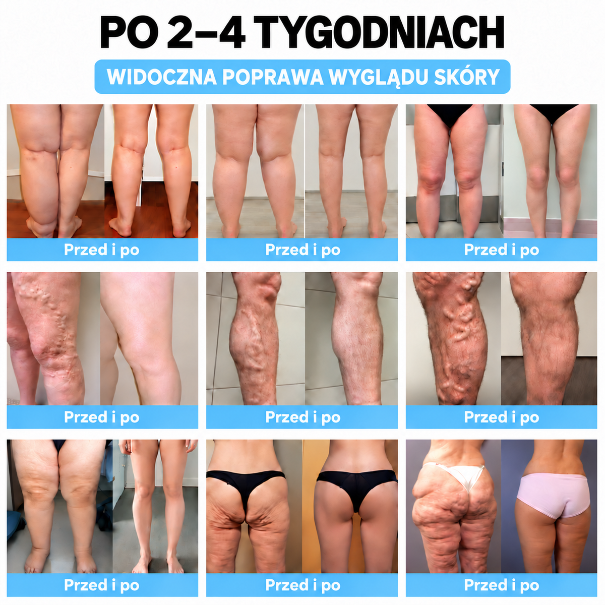 (🌸Ostatni dzień -70% zniżki🍀) SCNDR™ Ultradźwiękowa opaska spalająca tłuszcz oraz opaska z daleką podczerwienią wspierająca równowagę poziomu cukru we krwi Detox Wristband