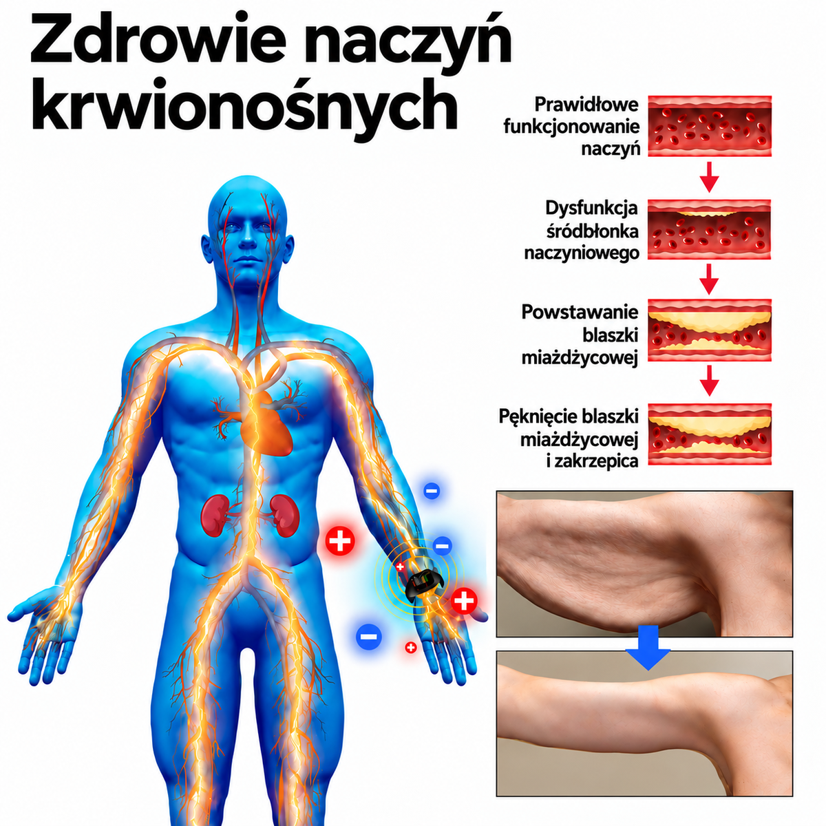 (🌸Ostatni dzień -70% zniżki🍀) SCNDR™ Ultradźwiękowa opaska spalająca tłuszcz oraz opaska z daleką podczerwienią wspierająca równowagę poziomu cukru we krwi Detox Wristband