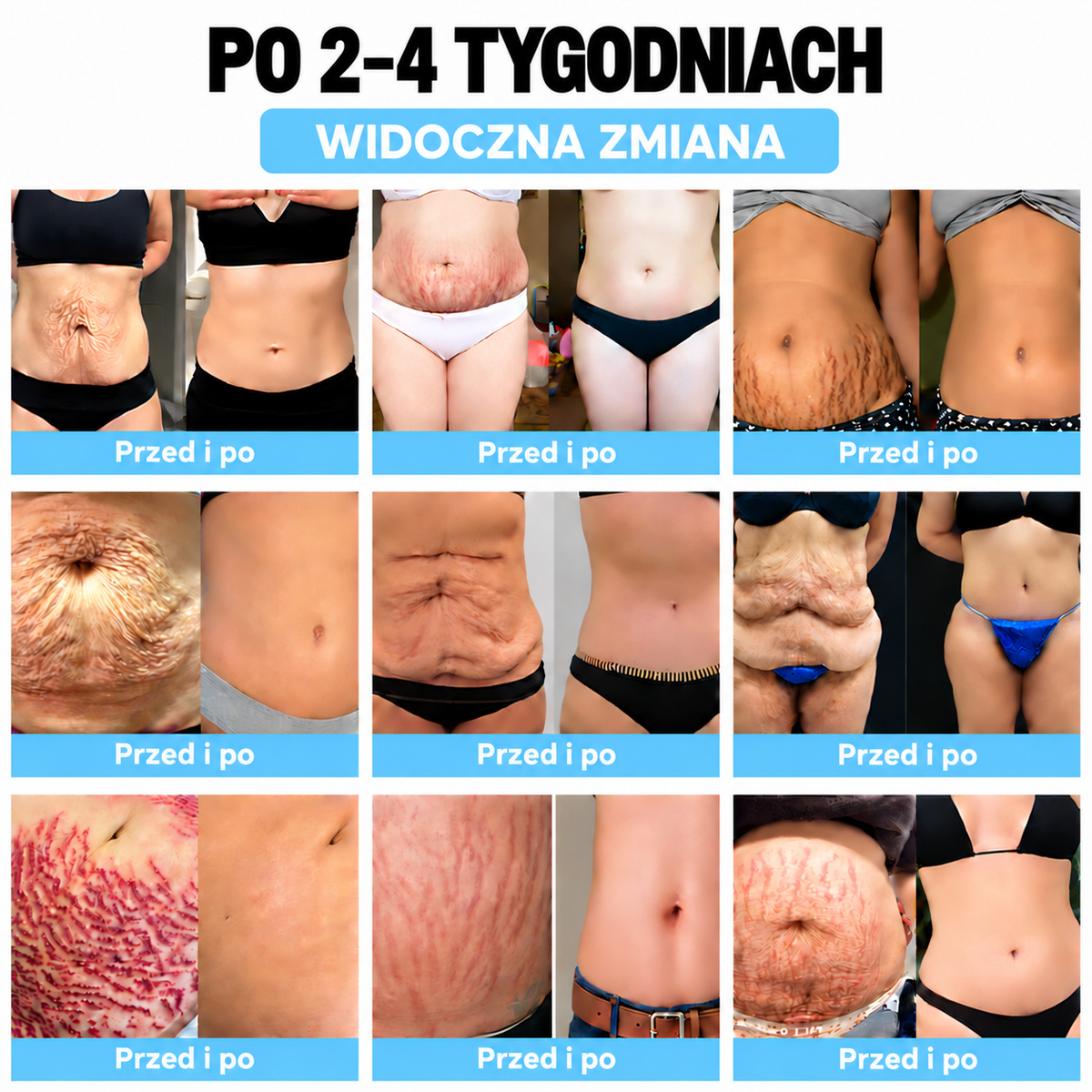 (🌸Ostatni dzień -70% zniżki🍀) SCNDR™ Ultradźwiękowa opaska spalająca tłuszcz oraz opaska z daleką podczerwienią wspierająca równowagę poziomu cukru we krwi Detox Wristband